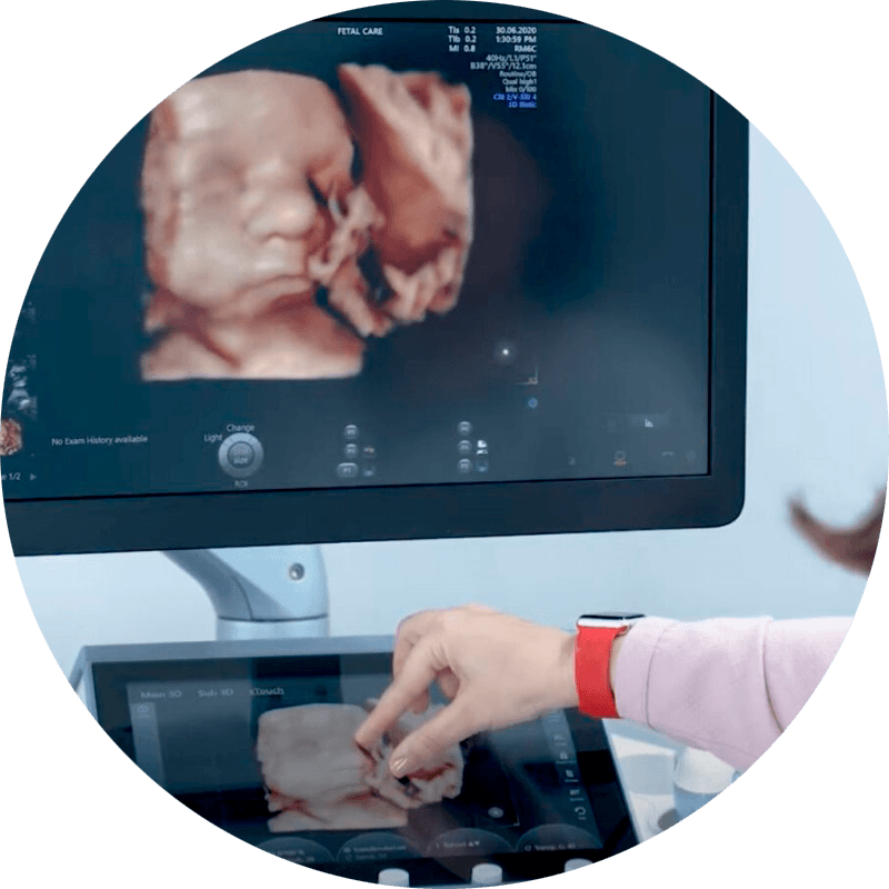 ecografias hiperrealistas